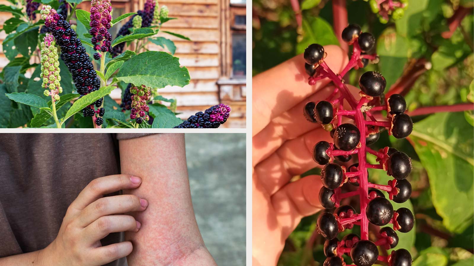 touching poisonous pokeweed with bare hands and showing rash