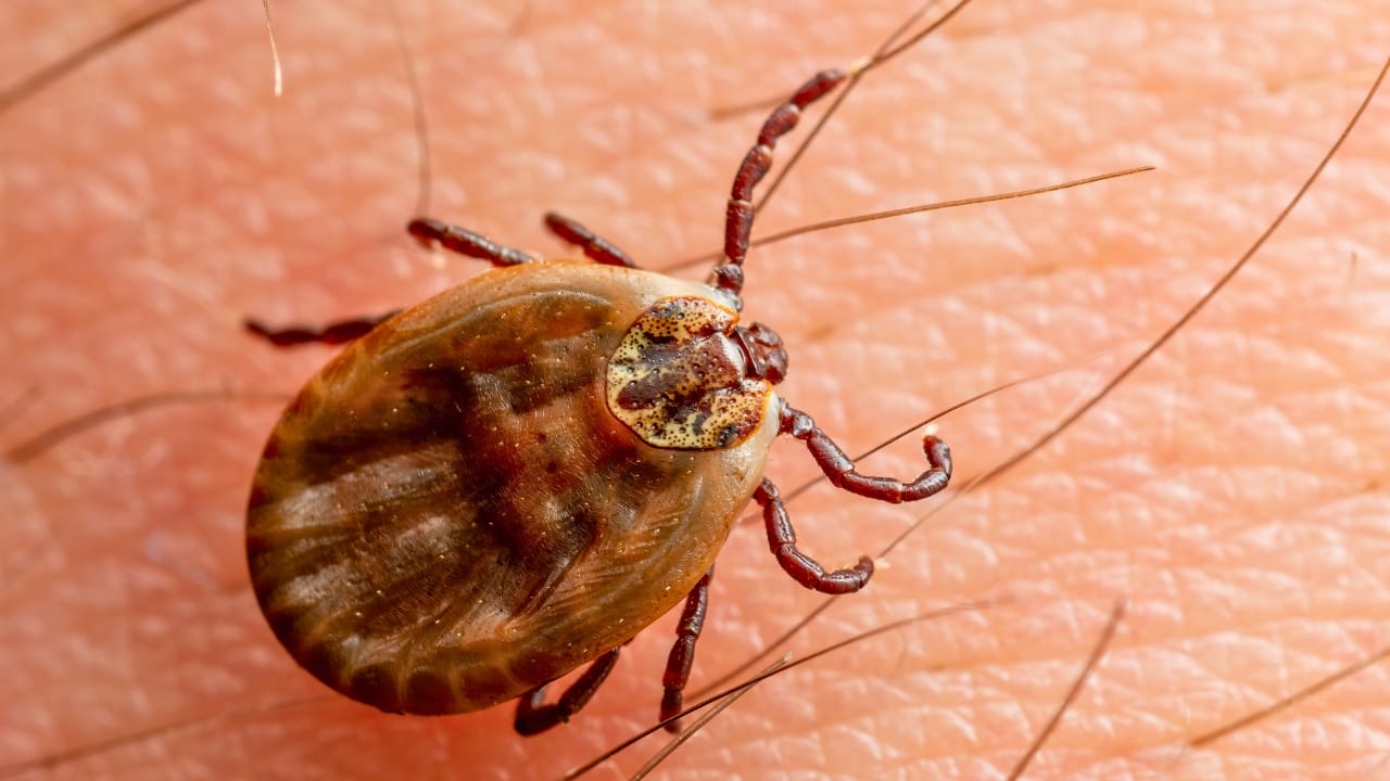 7 U.S. States Facing a Tick Population & Lyme Disease Surge - Encephalitis Tick on Skin ss2479716539