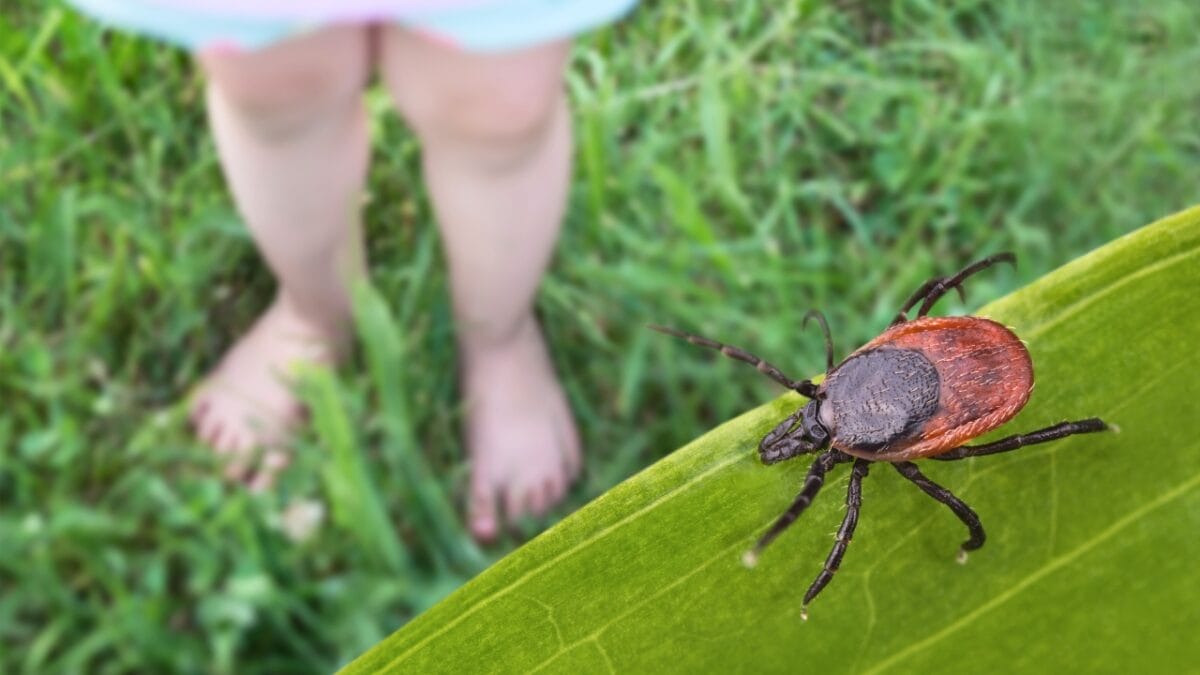 7 U.S. States Facing a Tick Population & Lyme Disease Surge - barefoot child with close up tick ss2149760279