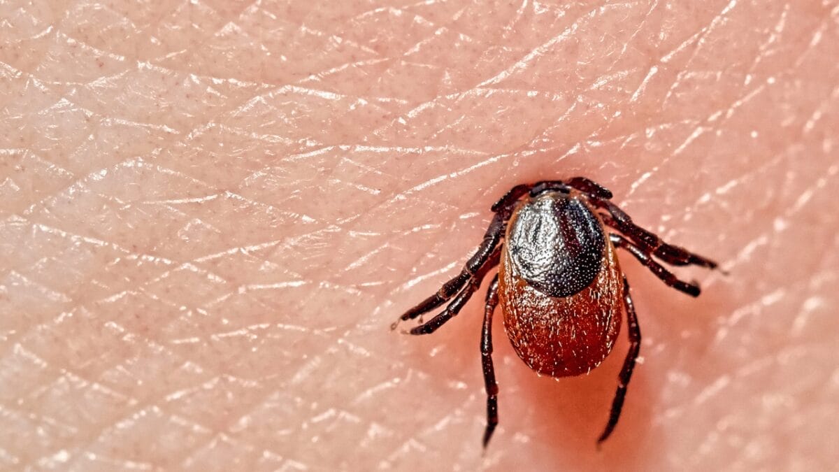 7 U.S. States Facing a Tick Population & Lyme Disease Surge - macro shot of a tick biting on skin ss1404869825