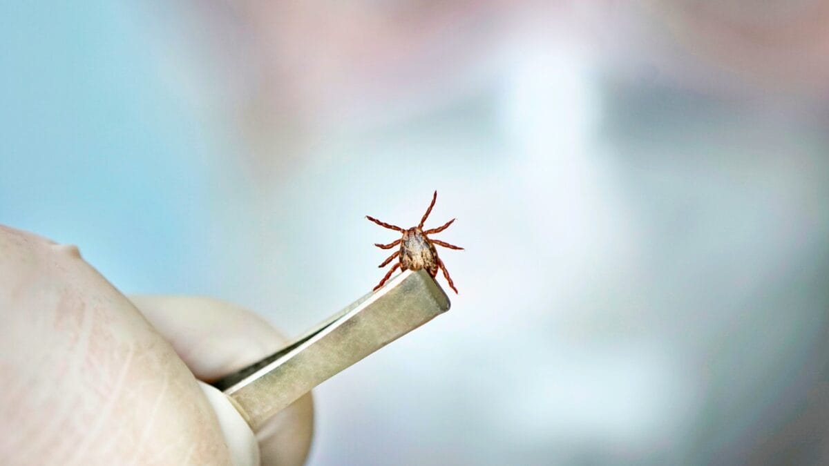 7 U.S. States Facing a Tick Population & Lyme Disease Surge - tick on a tweezer ss1724973562