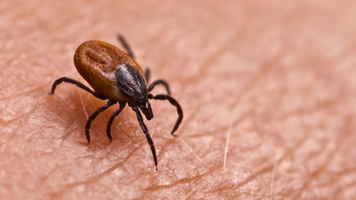 7 U.S. States Facing a Tick Population & Lyme Disease Surge - tick on skin ss1454468096
