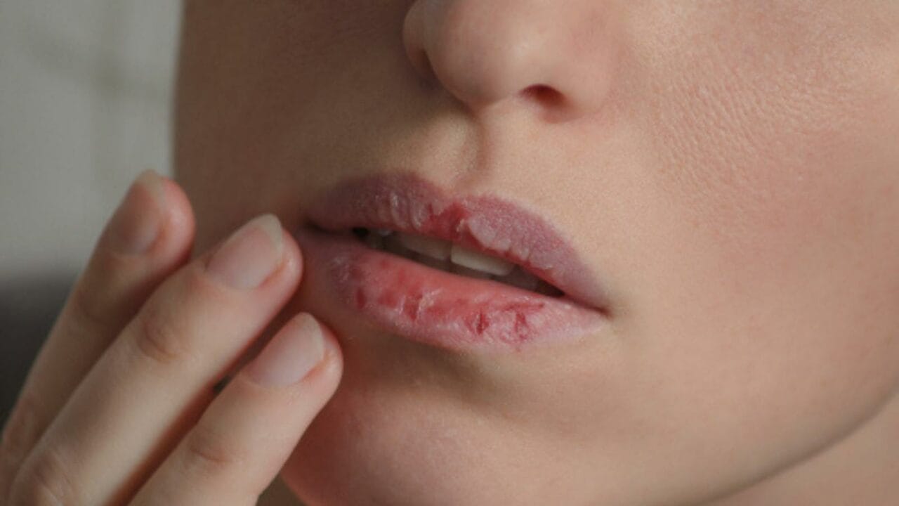 25 Things You Should Stop Buying & Start Making - lips dry ss788397742