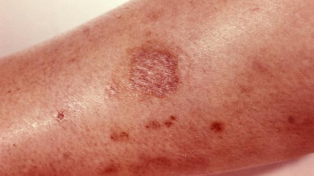 How to Identify a Brown Recluse Spider & Its Web Before It’s Too Late - brown recluse spider bite wc