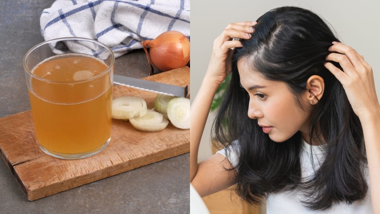 Onion Juice Stimulates Hair Growth— Experts Share the Science Behind It - glass of onion juice ss2164399939 woman checking her damaged hair ss2346761841