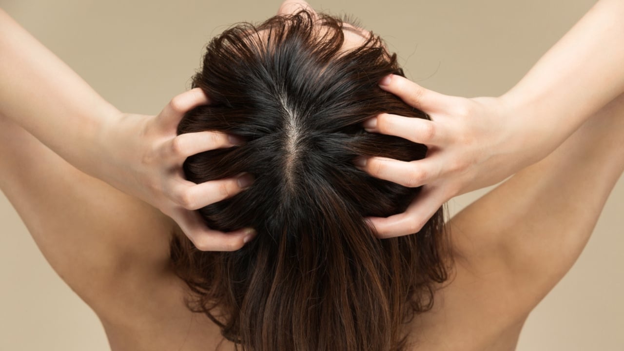 15 Everyday Problems Honey Can Solve Naturally - woman is massaging the scalp ss2006225198 dpdgm